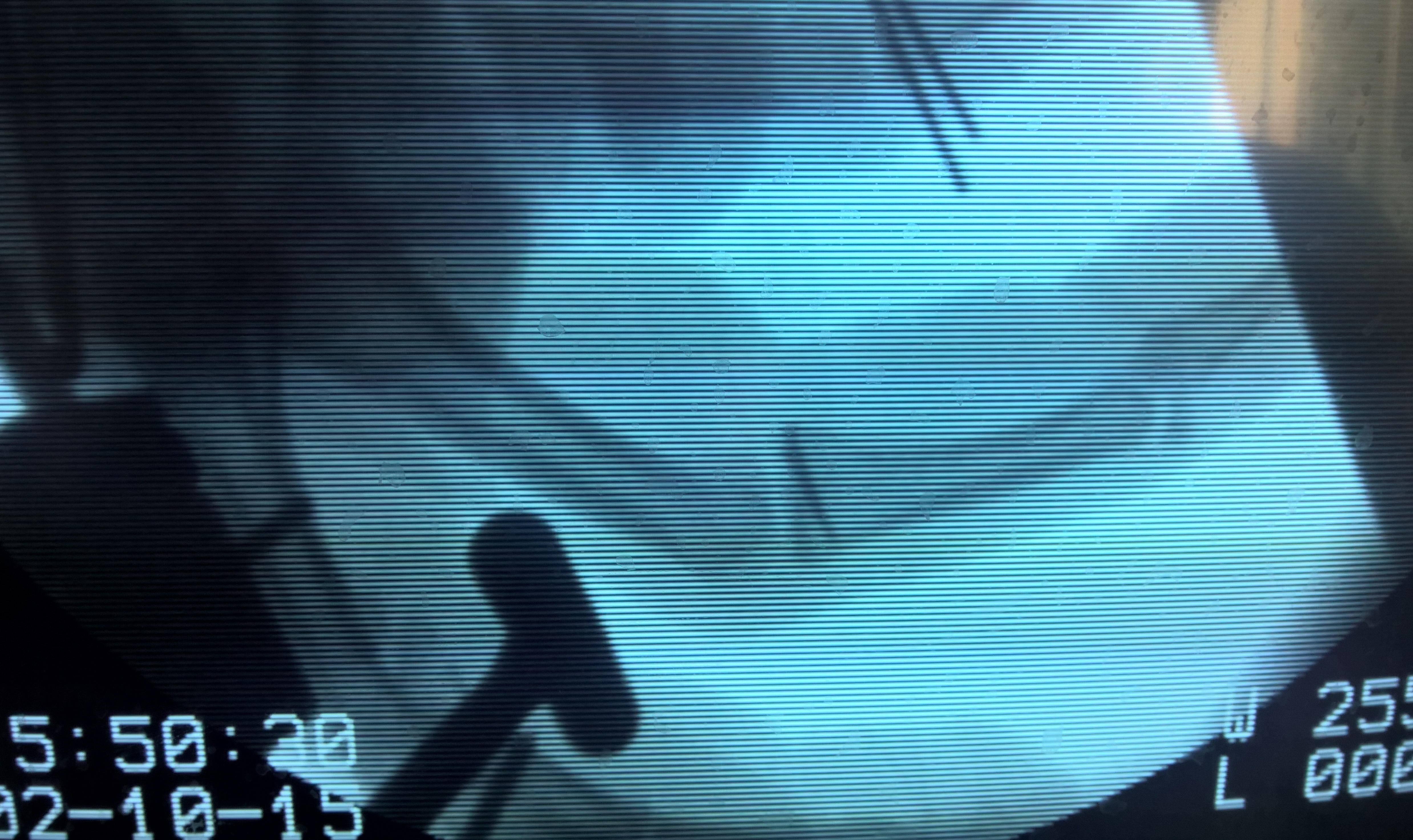 Лечение травм и заболеваний кисти