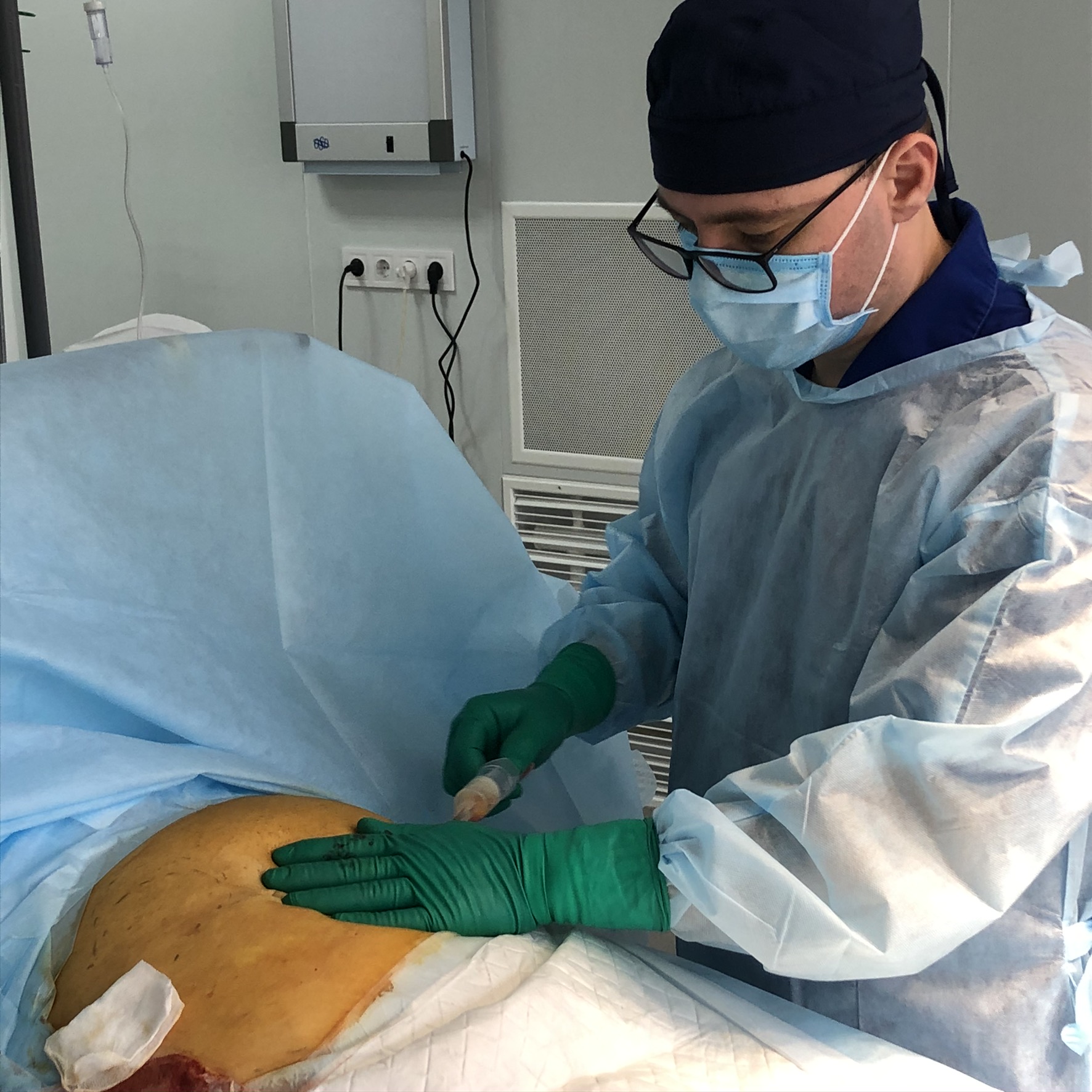 ACP SVF терапия 